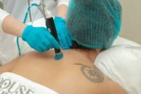 Top 8 Tattoo Removal Myths Experts Want You to Stop Believing