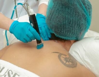Top 8 Tattoo Removal Myths Experts Want You to Stop Believing